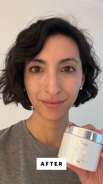 Selfie of Deanna Pai after using the SkinMedica Even Correct Brightening Treatment Pads